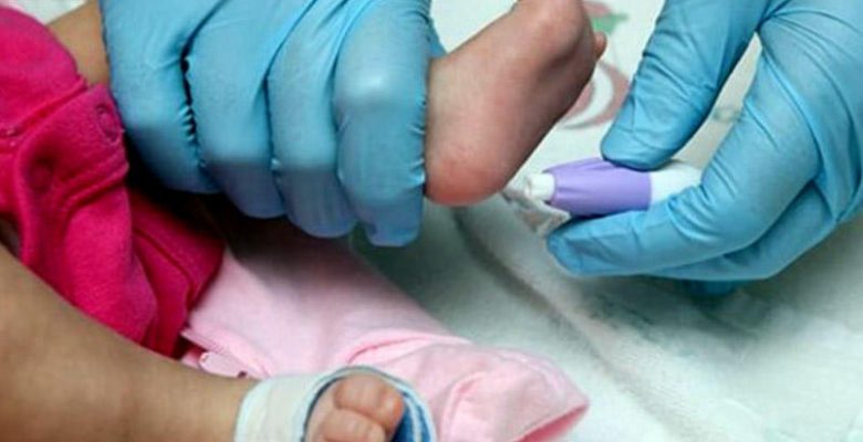 Yeni Doğan Bebeklerde Topuk Kanı Testi Nedir ?