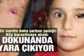 Bir ilde daha şarbon paniği