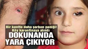 Bir ilde daha şarbon paniği