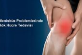 Kök Hücre Tedavisi Menisküs Yırtıklarını Ameliyatsız Tedavi Ediyor!